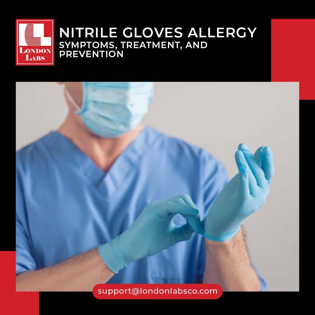 Nitrile Gloves Allergy Symptoms, Treatment, and Prevention London Labs